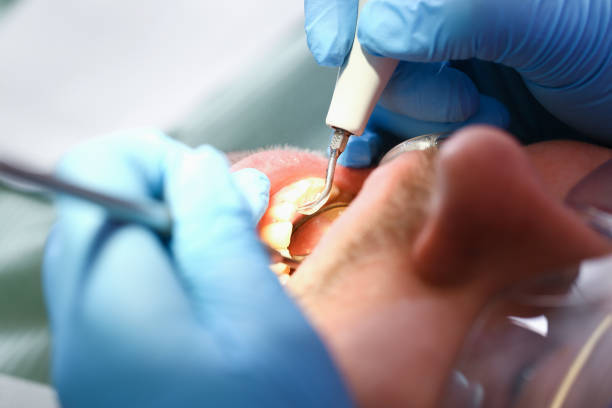 Best Emergency Broken Tooth Repair in Fulshear, TX