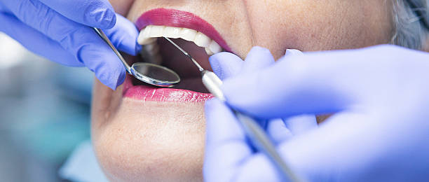 Best Emergency Root Canal Treatment in Fulshear, TX